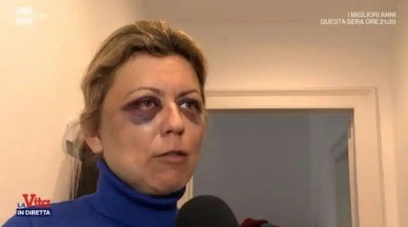 la dottoressa aggredita in via washington a milano   1