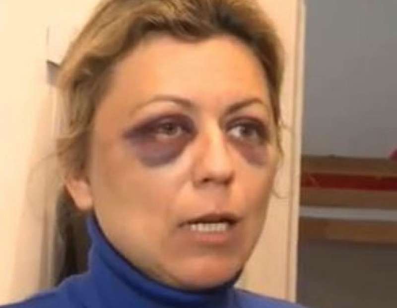 la dottoressa aggredita in via washington a milano 3