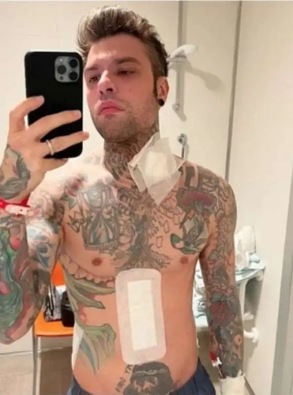 fedez