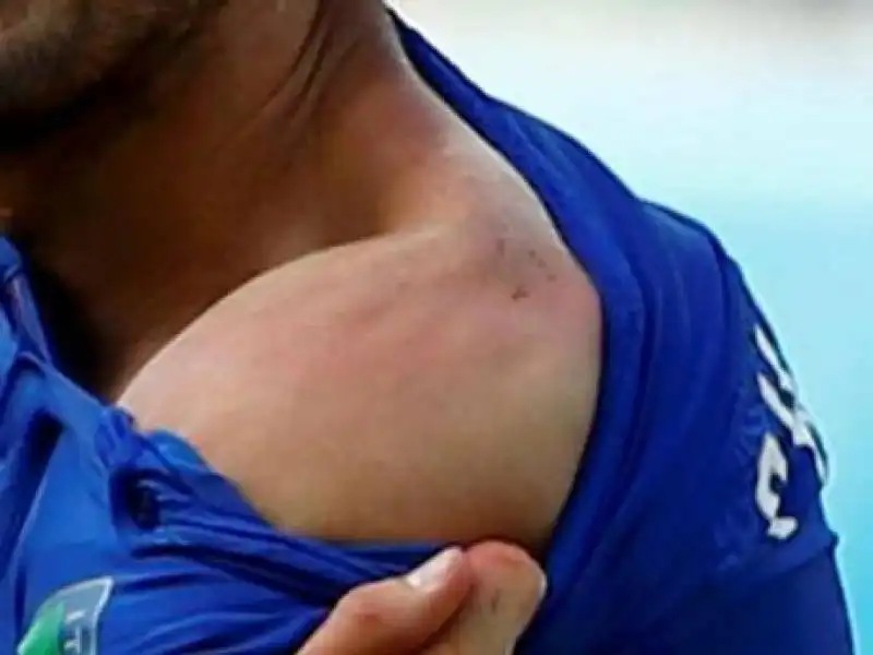 chiellini bite