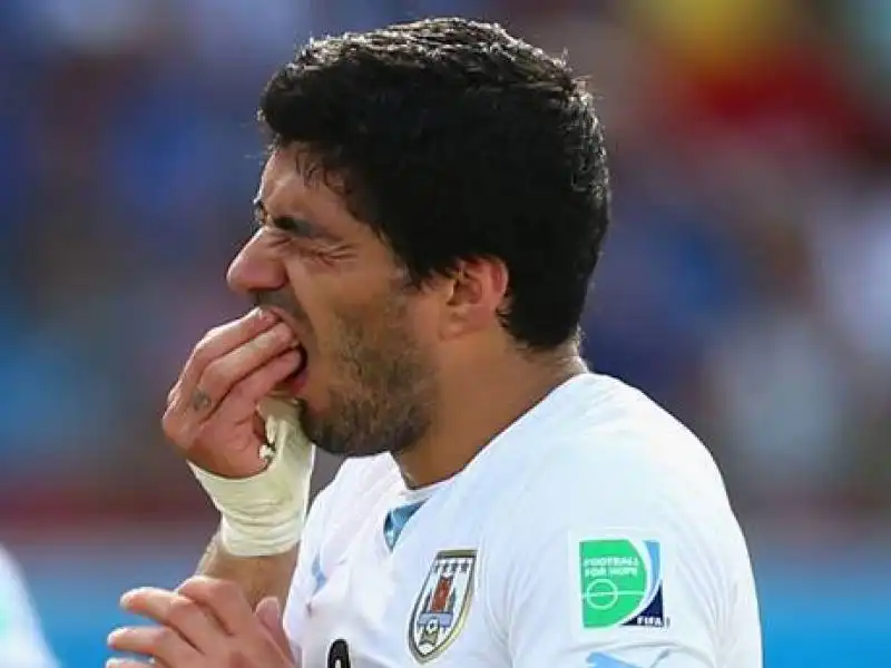 suarez teeth