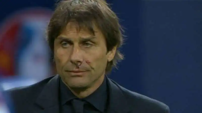 antonio conte sangue post gol  2