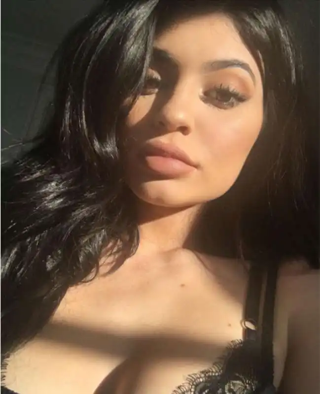 kylie jenner operazione labbra riuscita