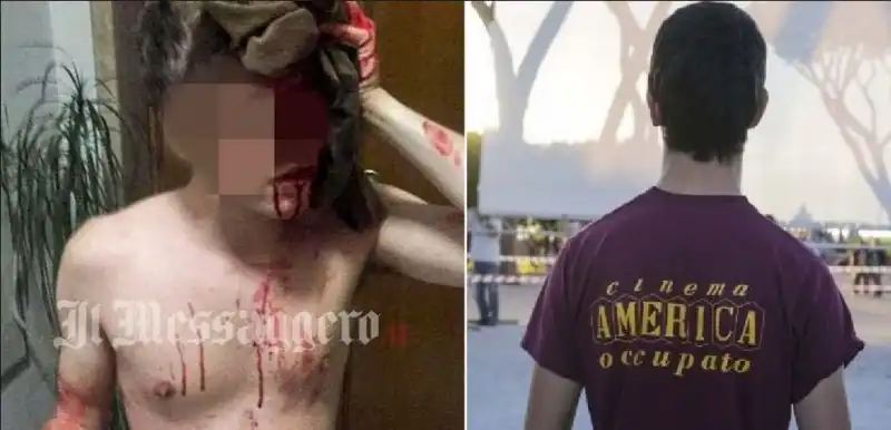 RAGAZZO PESTATO A ROMA