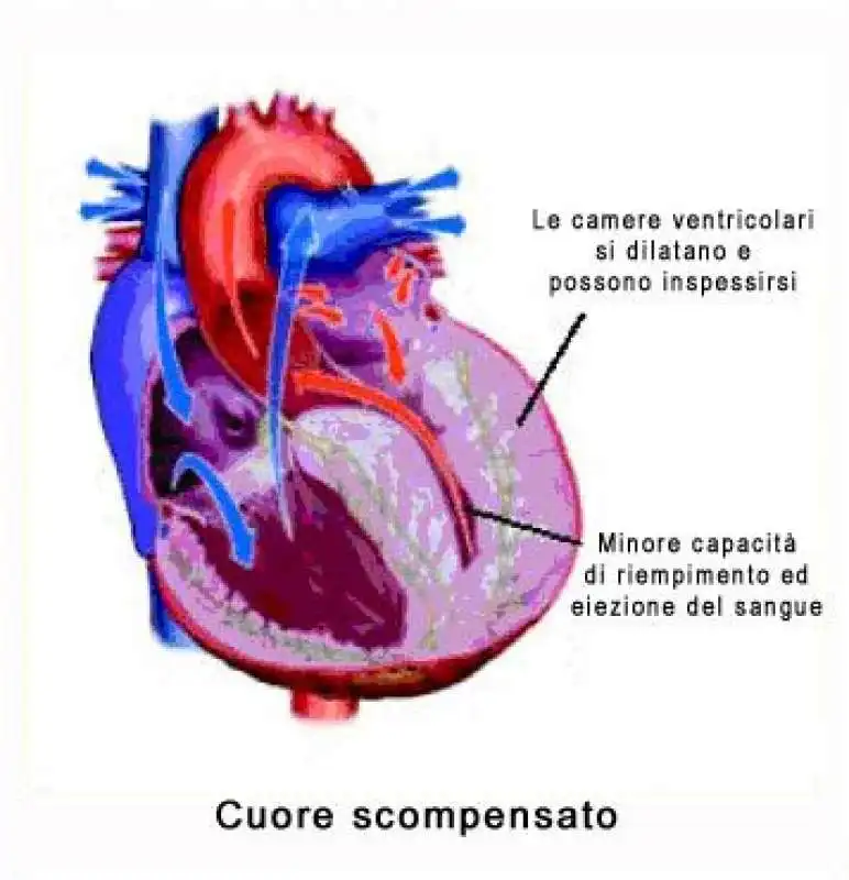 scompenso cardiaco 3