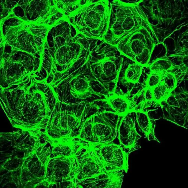 CELLULE ENDOTELIALI MENTRE RISPONDONO A UN FATTORE DI CRESCITA