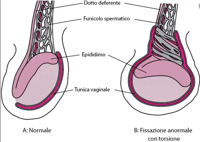 testicoli 2