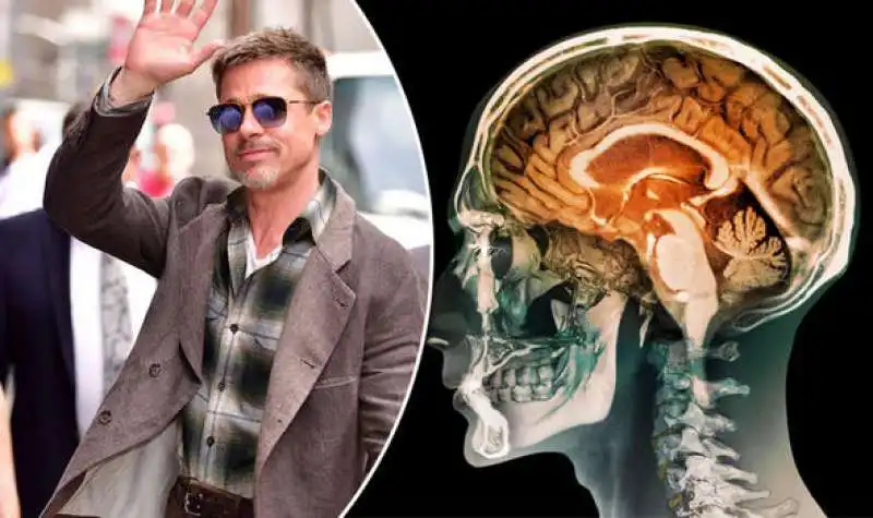 Brad Pitt prosopagnosia 