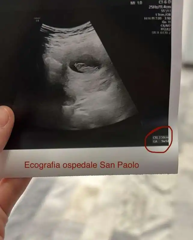 linda feki racconta il suo aborto su instagram   3