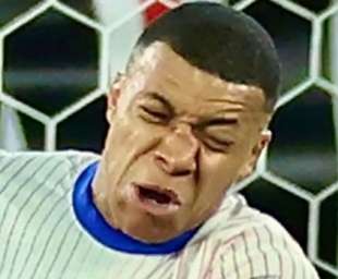 MBAPPE SI ROMPE IL NASO NELLA PARTITA CONTRO L'AUSTRIA