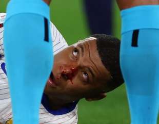 MBAPPE SI ROMPE IL NASO NELLA PARTITA CONTRO L'AUSTRIA