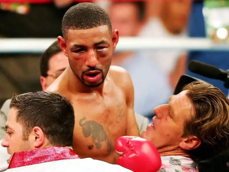 DIEGO CORRALES DOPO 