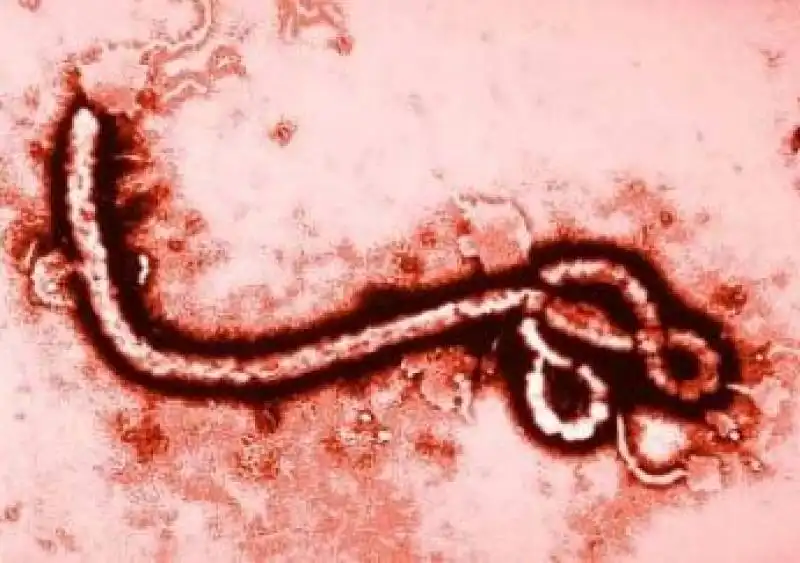 EBOLA