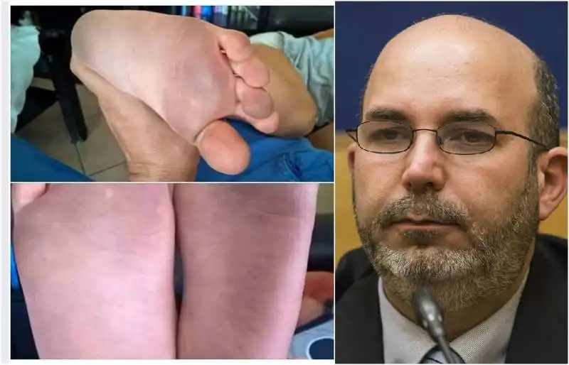 CRIMI PIEDI NERI 1