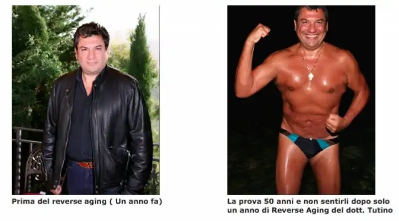 matteo tutino promuove il reverse aging