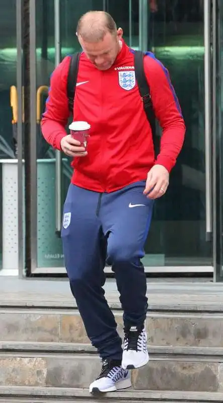 wayne rooney e i capelli  3