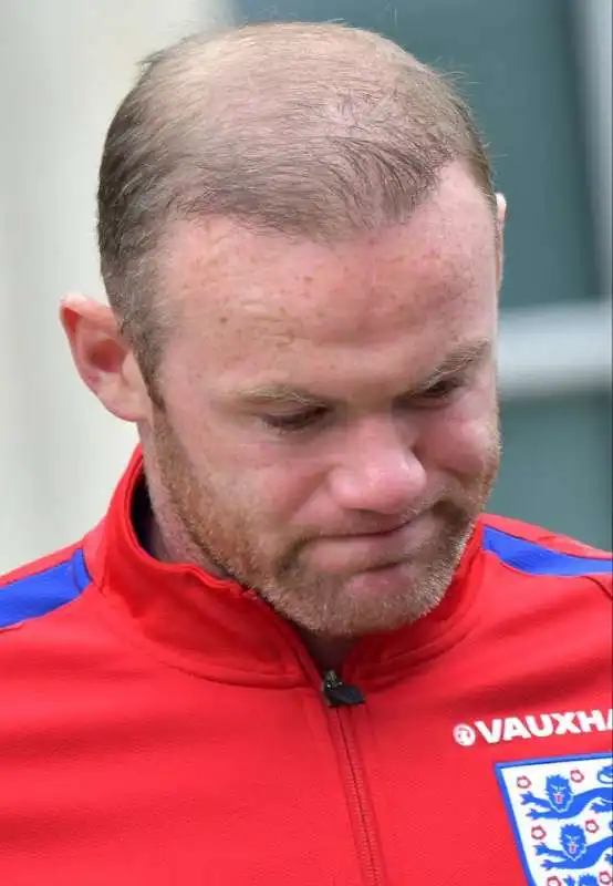 wayne rooney e i capelli  8