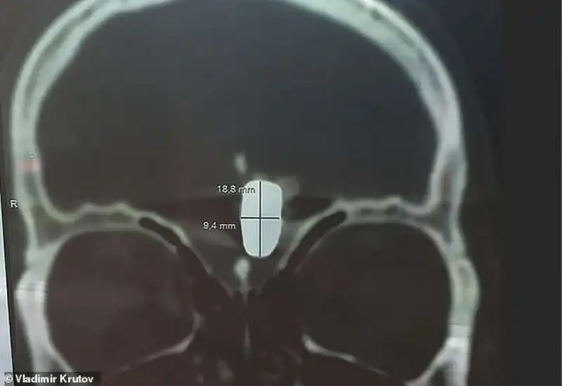 il proiettile nel cervello di vladimir krutov