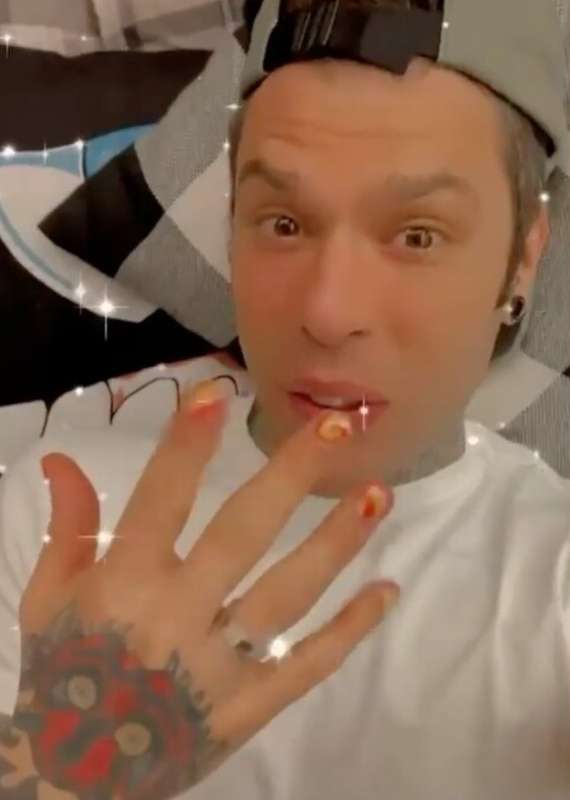 fedez e gli smalti noon 2