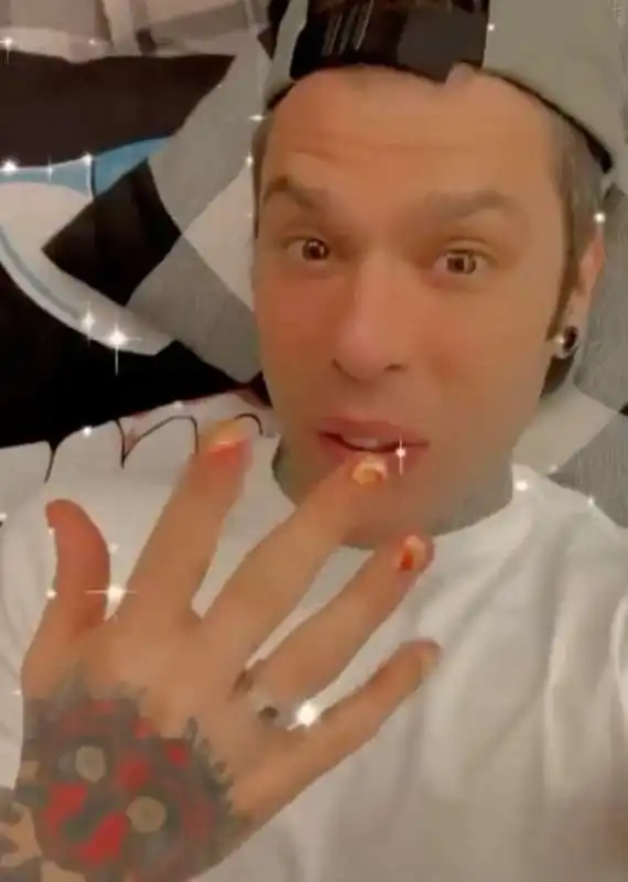 fedez e gli smalti noon 2