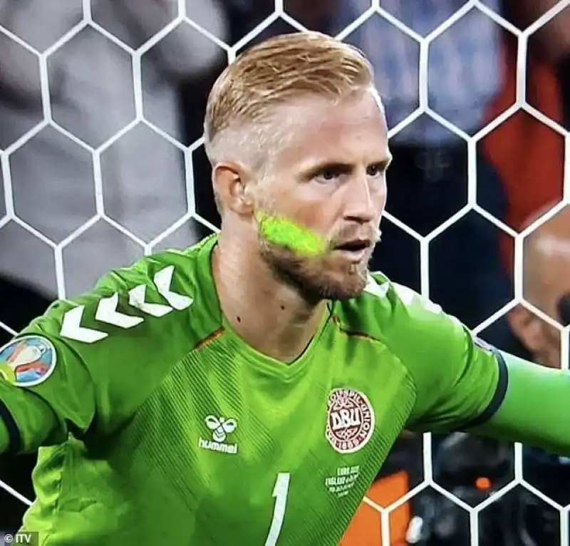 Il laser su Schmeichel