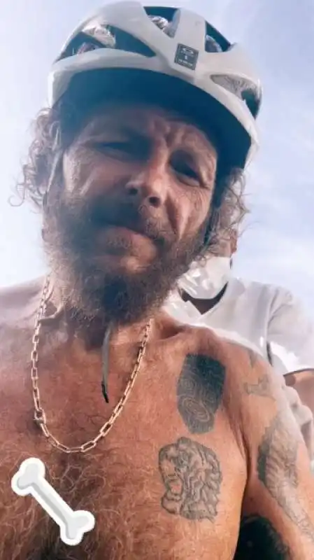 jovanotti dopo l incidente in bicicletta a santo domingo   1