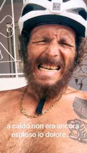 jovanotti dopo l incidente in bicicletta a santo domingo 4