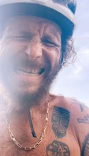 jovanotti dopo l incidente in bicicletta a santo domingo 5