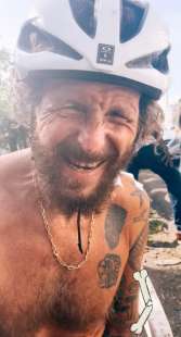 jovanotti dopo l incidente in bicicletta a santo domingo 6