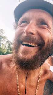 jovanotti dopo l incidente in bicicletta a santo domingo 7