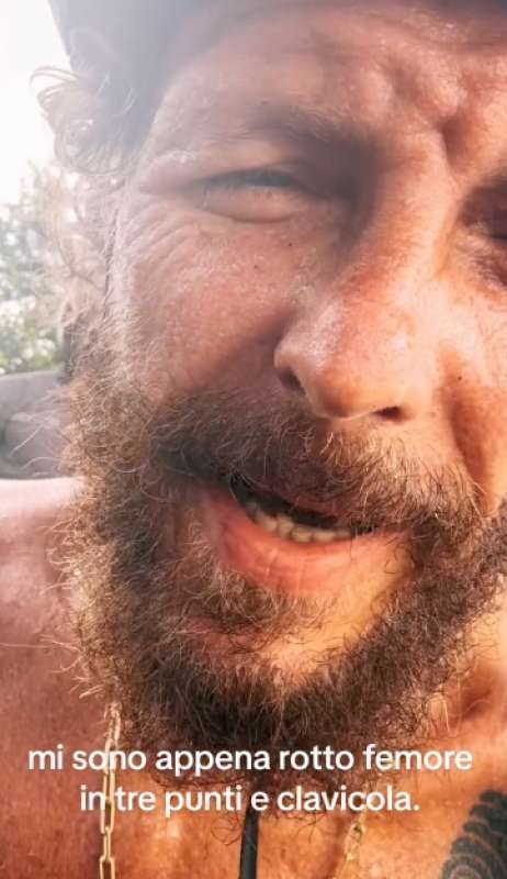 jovanotti dopo l incidente in bicicletta a santo domingo 8