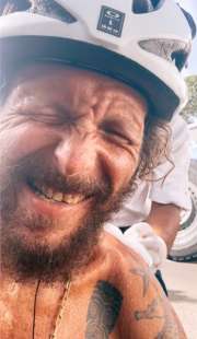 jovanotti dopo l incidente in bicicletta a santo domingo 9