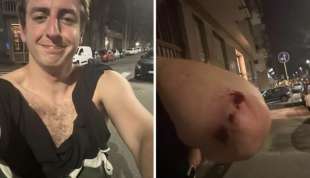 andrea joly aggredito da militanti di estrema destra a torino 2