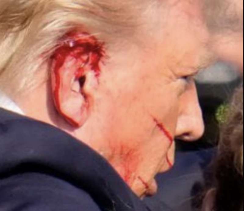 L ORECCHIO DI DONALD TRUMP DOPO L ATTENTATO