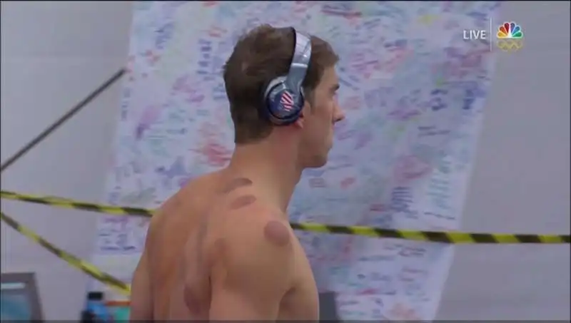 michael phelps cupping    