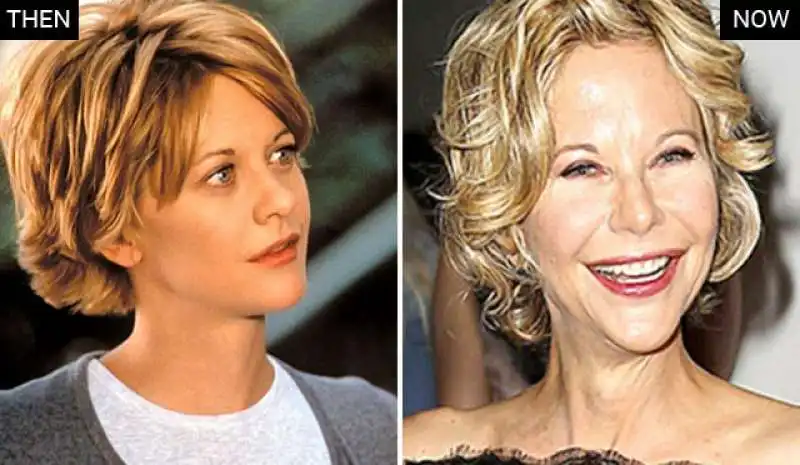 meg ryan troppa plastica   