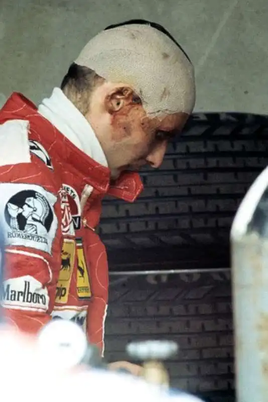 niki lauda 10