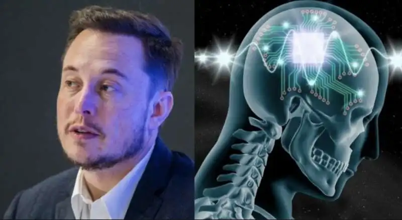 elon musk neuralink 2