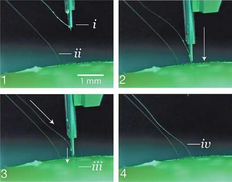 come funziona il robot che inserisce il chip neuralink nel cervello 