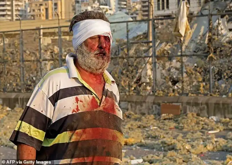 un uomo ferito dall'esplosione a beirut