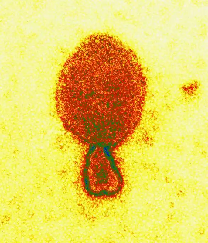 langya virus