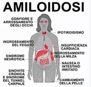 AMILOIDOSI