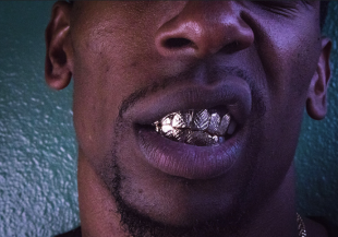 grillz - dentatura in oro