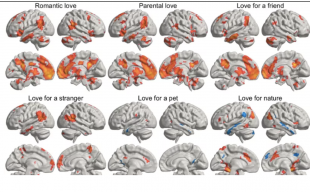 IL CERVELLO E I DIVERSI TIPI DI AMORE