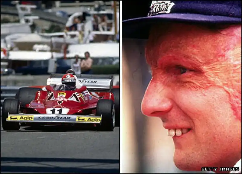 NIKI LAUDA DOPO L INCIDENTE 