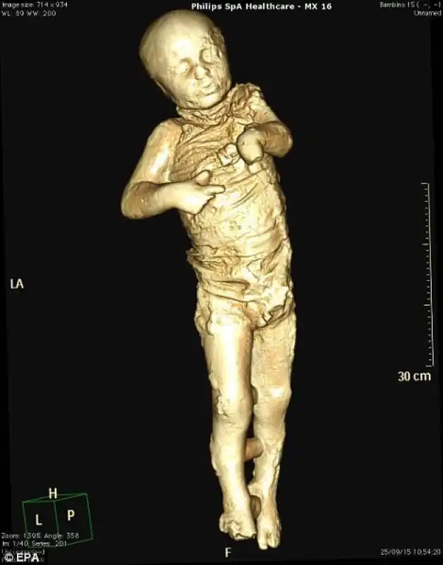 scanner di un bambino di 4 anni