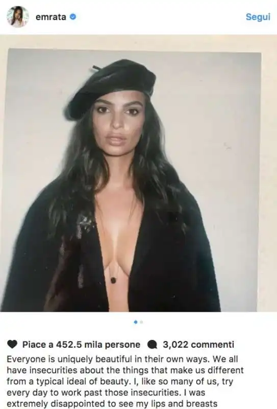 emily ratajkowski tette originali