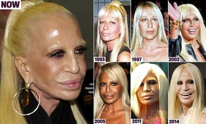 la trasformazione di donatella versace