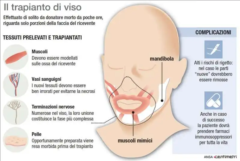 trapianto di faccia 1