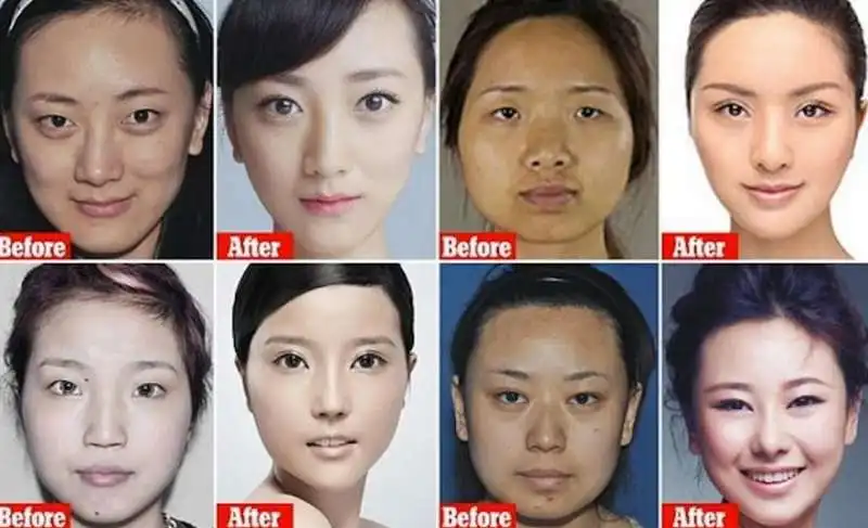 ritocchini col botox in cina 2